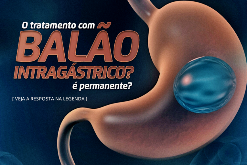 O tratamento com balão intragástrico é permanente?